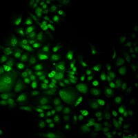 mEER Mouse E6/E7/hRas Oropharynx Epithelial Cell Line | SCC626